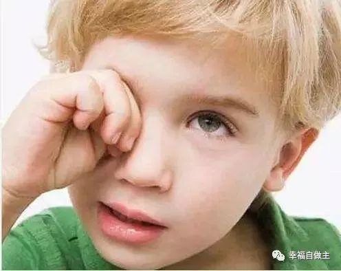 姜参水洗眼快速缓解眼痒症状案例