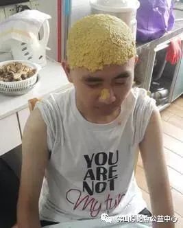 原始点调理九年史牛皮癣:二十天大变化