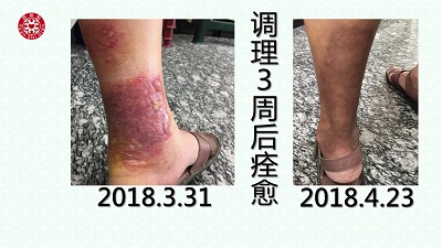 ★张钊汉原始点健康资讯网 开通