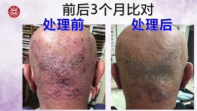 ★张钊汉原始点健康资讯网 开通