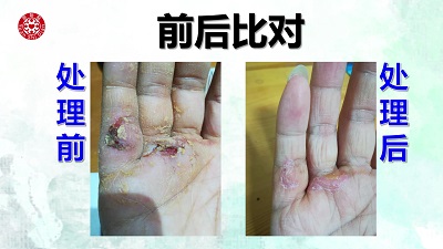 ★张钊汉原始点健康资讯网 开通