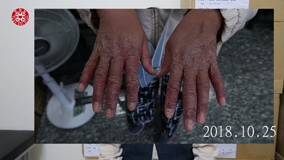 ★张钊汉原始点健康资讯网 开通