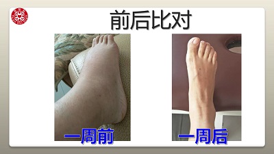 ★张钊汉原始点健康资讯网 开通