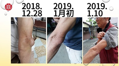 ★张钊汉原始点健康资讯网 开通