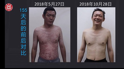 ★张钊汉原始点健康资讯网 开通