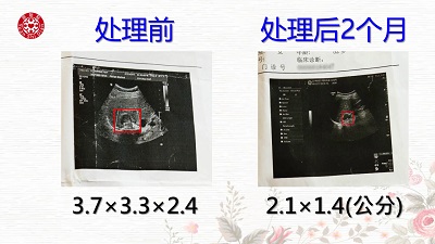 ★张钊汉原始点健康资讯网 开通