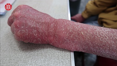 ★张钊汉原始点健康资讯网 开通