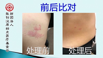 ★张钊汉原始点健康资讯网 开通