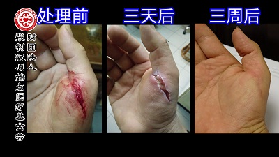 ★张钊汉原始点健康资讯网 开通