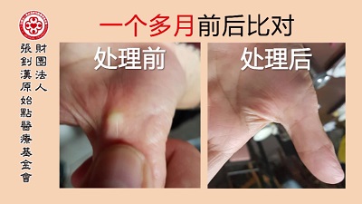 ★张钊汉原始点健康资讯网 开通