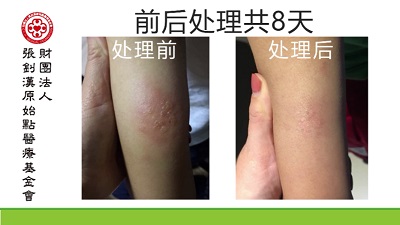 ★张钊汉原始点健康资讯网 开通