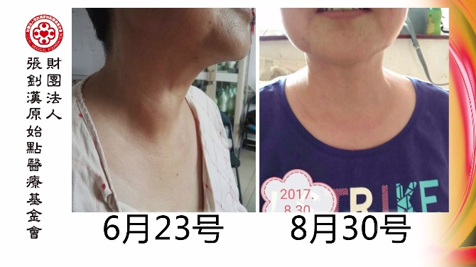 ★张钊汉原始点健康资讯网 开通