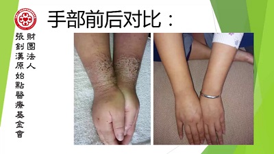 ★张钊汉原始点健康资讯网 开通