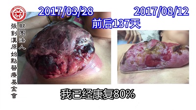 ★张钊汉原始点健康资讯网 开通