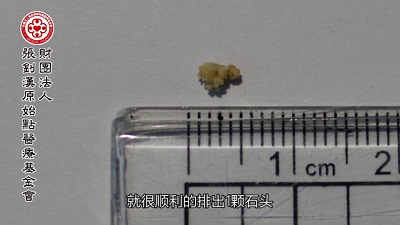 ★张钊汉原始点健康资讯网 开通