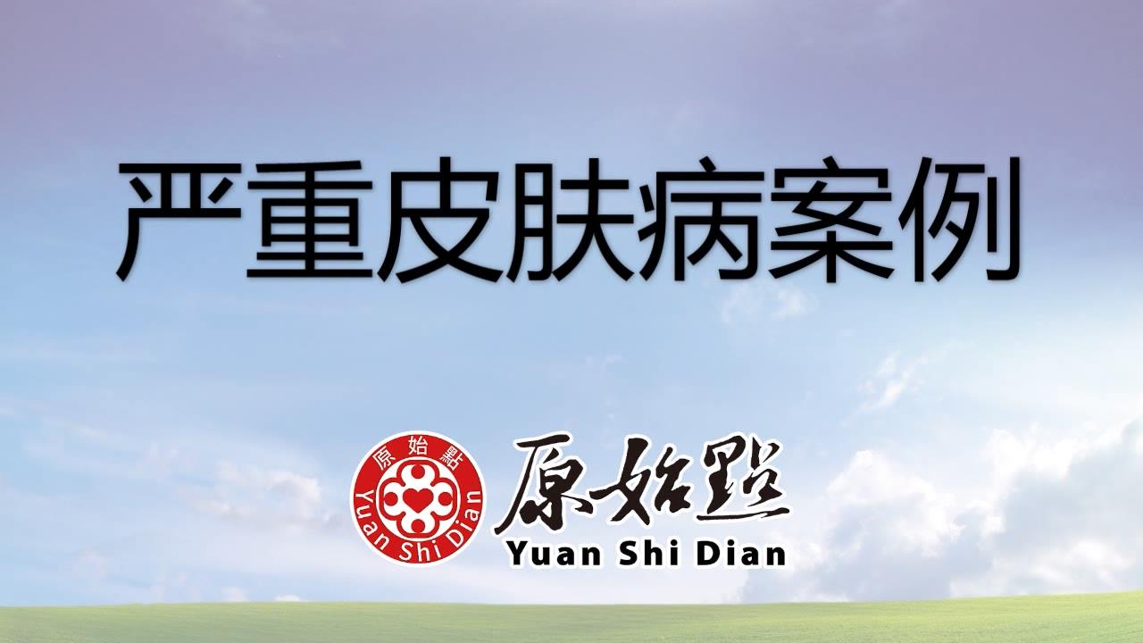 ★张钊汉原始点健康资讯网 开通