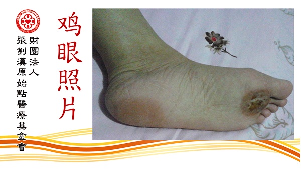 ★张钊汉原始点健康资讯网 开通