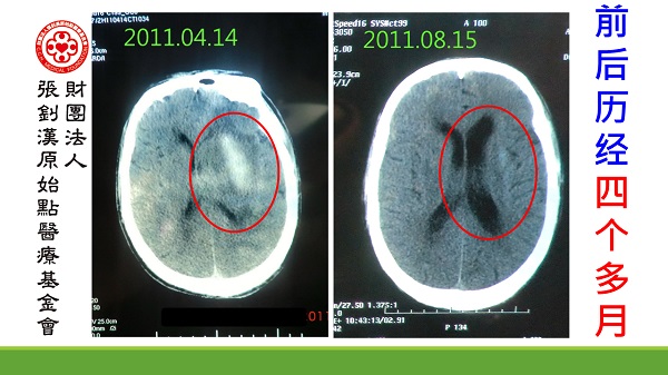 ★张钊汉原始点健康资讯网 开通