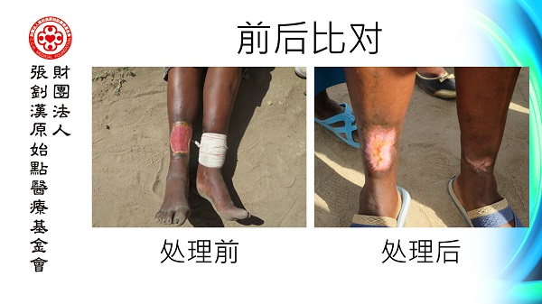 ★张钊汉原始点健康资讯网 开通