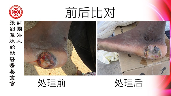 ★张钊汉原始点健康资讯网 开通