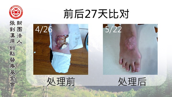 ★张钊汉原始点健康资讯网 开通