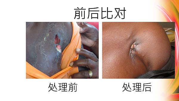 ★张钊汉原始点健康资讯网 开通