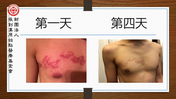 ★张钊汉原始点健康资讯网 开通