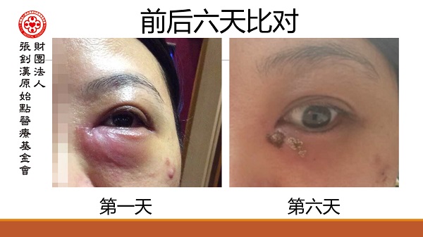 ★张钊汉原始点健康资讯网 开通