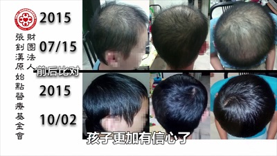 ★张钊汉原始点健康资讯网 开通