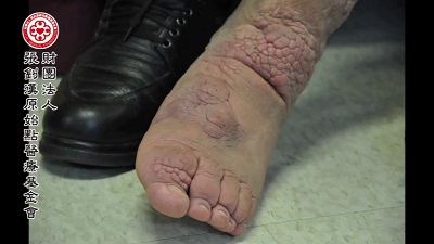 ★张钊汉原始点健康资讯网 开通