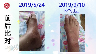 ★张钊汉原始点健康资讯网 开通