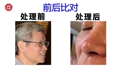 ★张钊汉原始点健康资讯网 开通