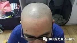 原始点调理九年史牛皮癣:二十天大变化 原始点调理九年史牛皮癣:二十天大变化