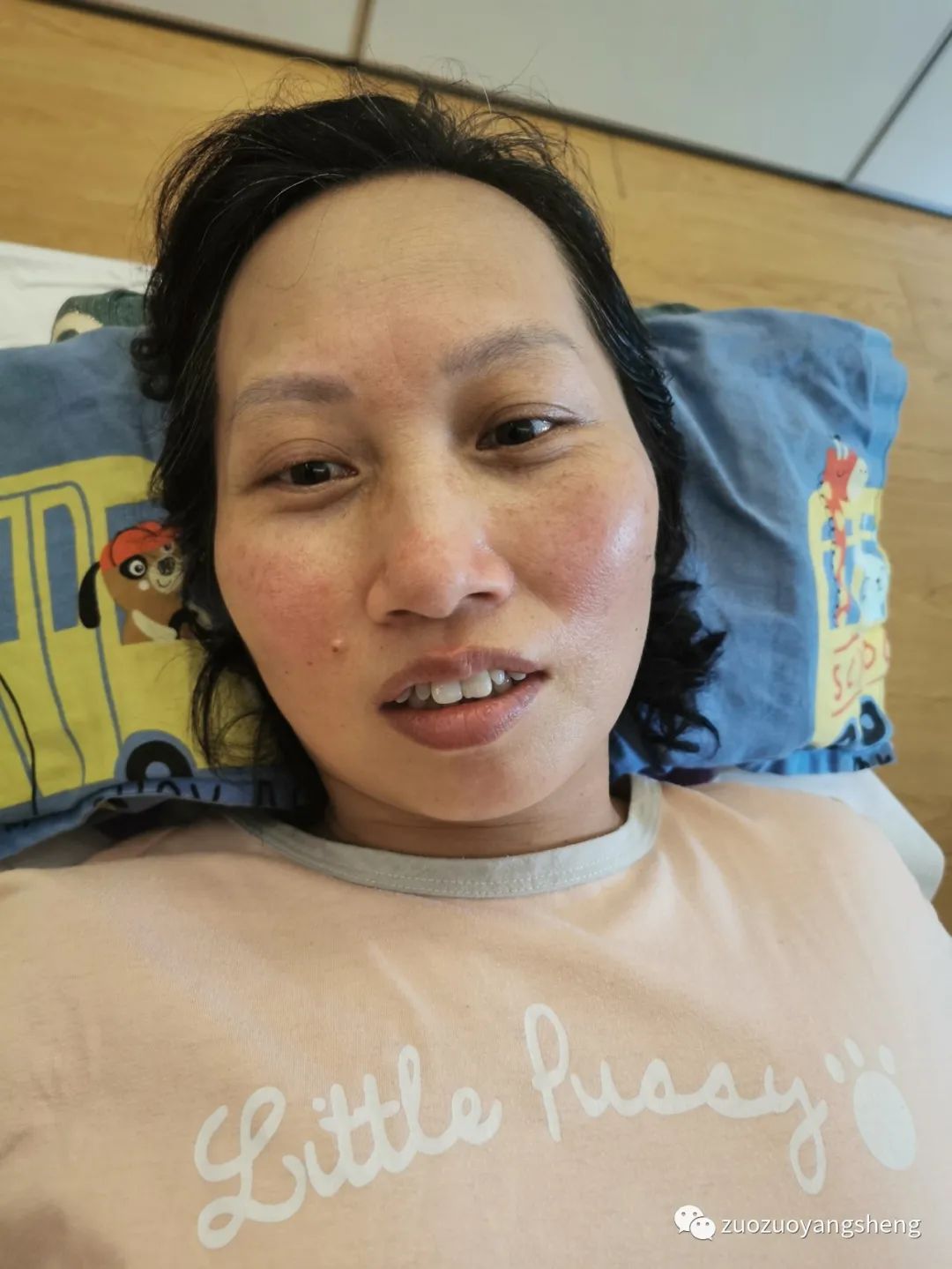 案例分享：原始点调理脸上严重玫瑰痤疮的案例