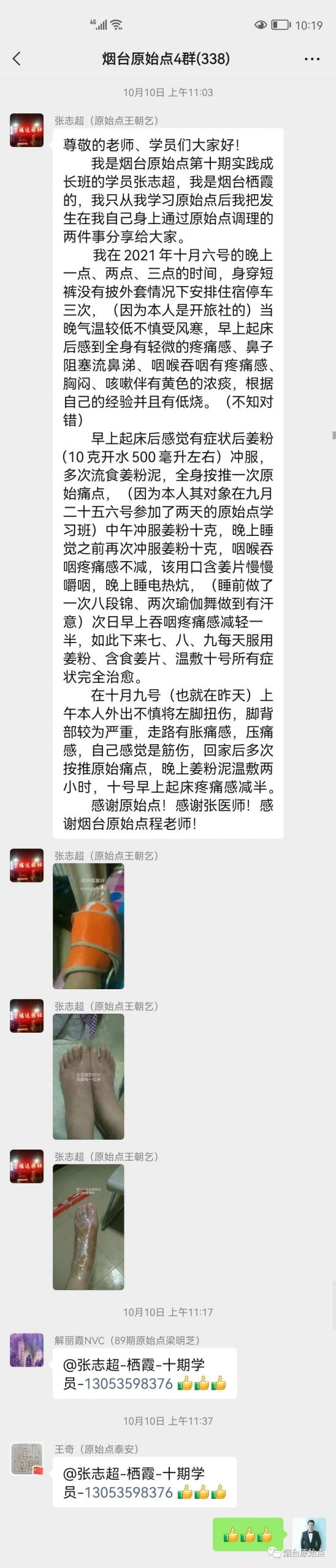 受风寒低烧全身微痛、咽喉吞咽疼、胸闷案例、左脚扭伤案例、结石疼痛案例、胆囊疼痛案例 受风寒低烧全身微痛、咽喉吞咽疼、胸闷案例、左脚扭伤案例、结石疼痛案例、胆囊疼痛案例