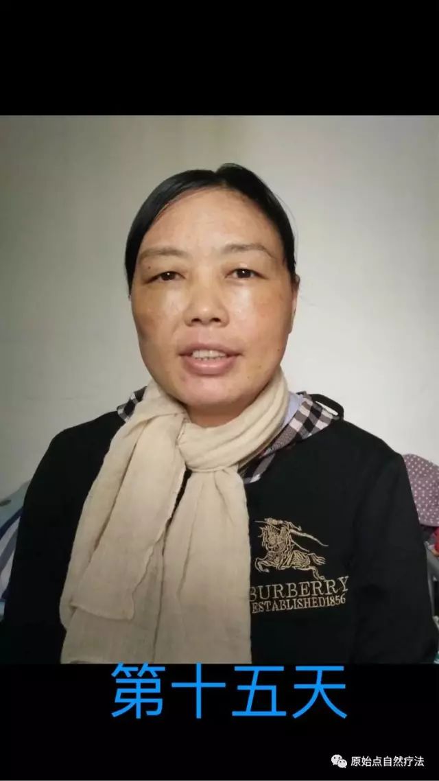 调理车祸案例 调理车祸案例