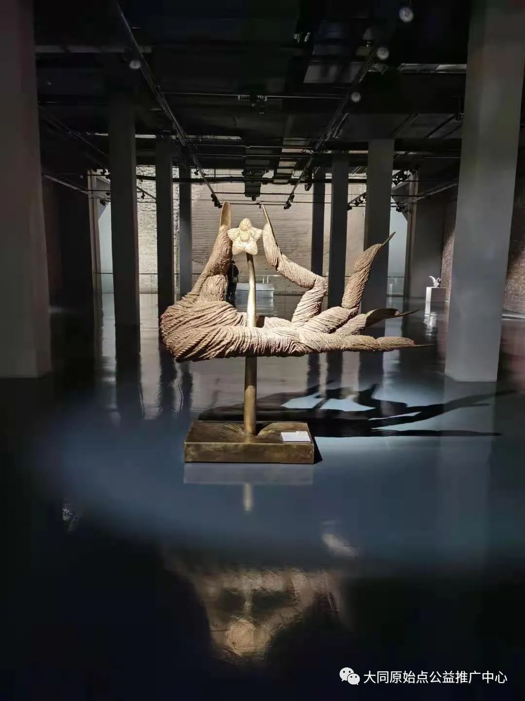 化学洗衣液灼伤眼睛、眼角膜脱落恢复案例 化学洗衣液灼伤眼睛、眼角膜脱落恢复案例