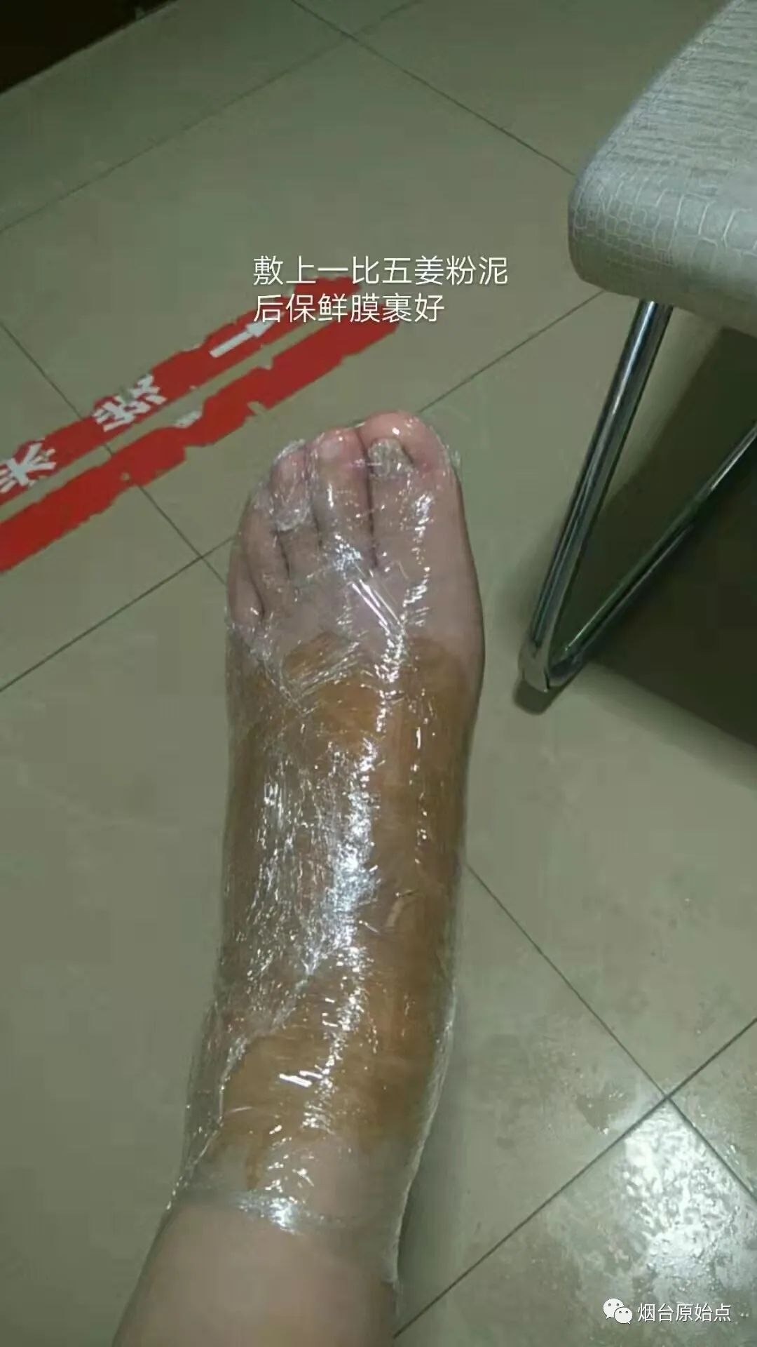 受风寒低烧全身微痛、咽喉吞咽疼、胸闷案例、左脚扭伤案例、结石疼痛案例、胆囊疼痛案例 受风寒低烧全身微痛、咽喉吞咽疼、胸闷案例、左脚扭伤案例、结石疼痛案例、胆囊疼痛案例