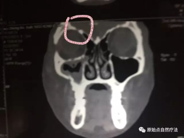 调理车祸案例 调理车祸案例