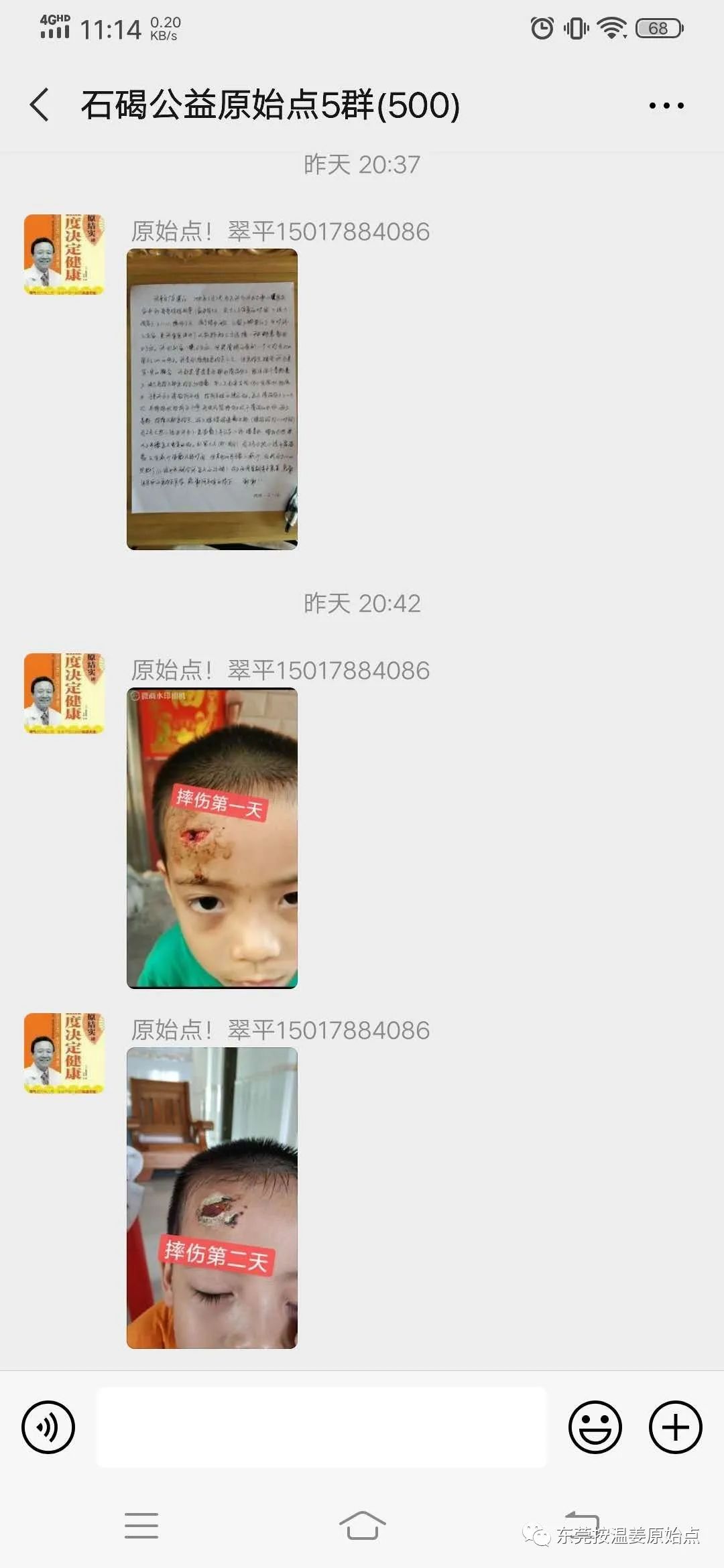 摔伤伤口大约长2CM深0.5CM,未缝针 摔伤伤口大约长2CM深0.5CM,未缝针