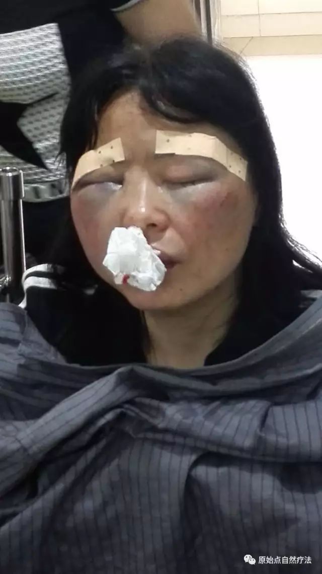 调理车祸案例 调理车祸案例