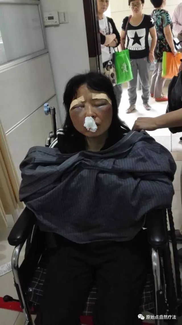 调理车祸案例 调理车祸案例