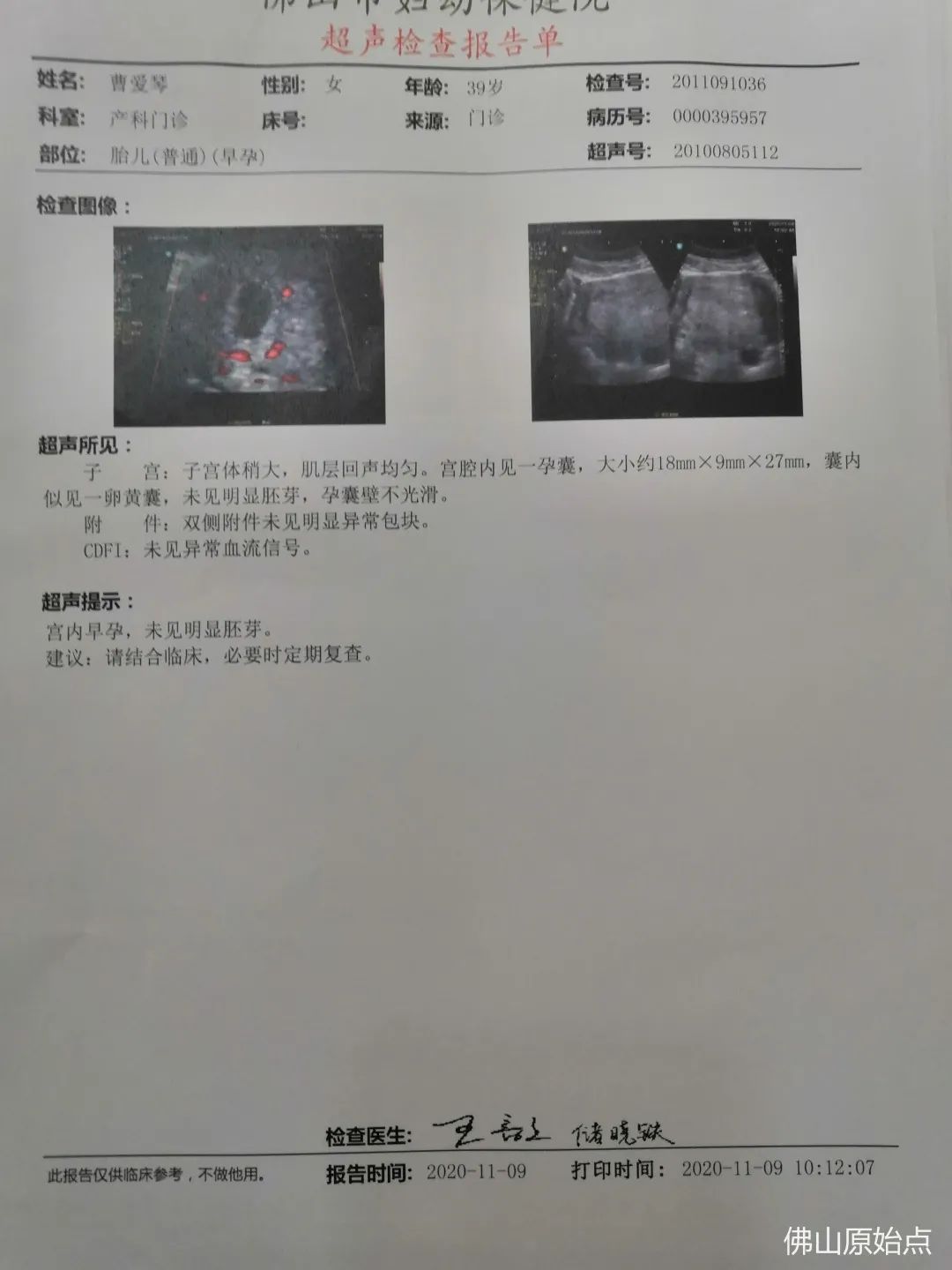原始点调理胎死腹中案例 原始点调理胎死腹中案例