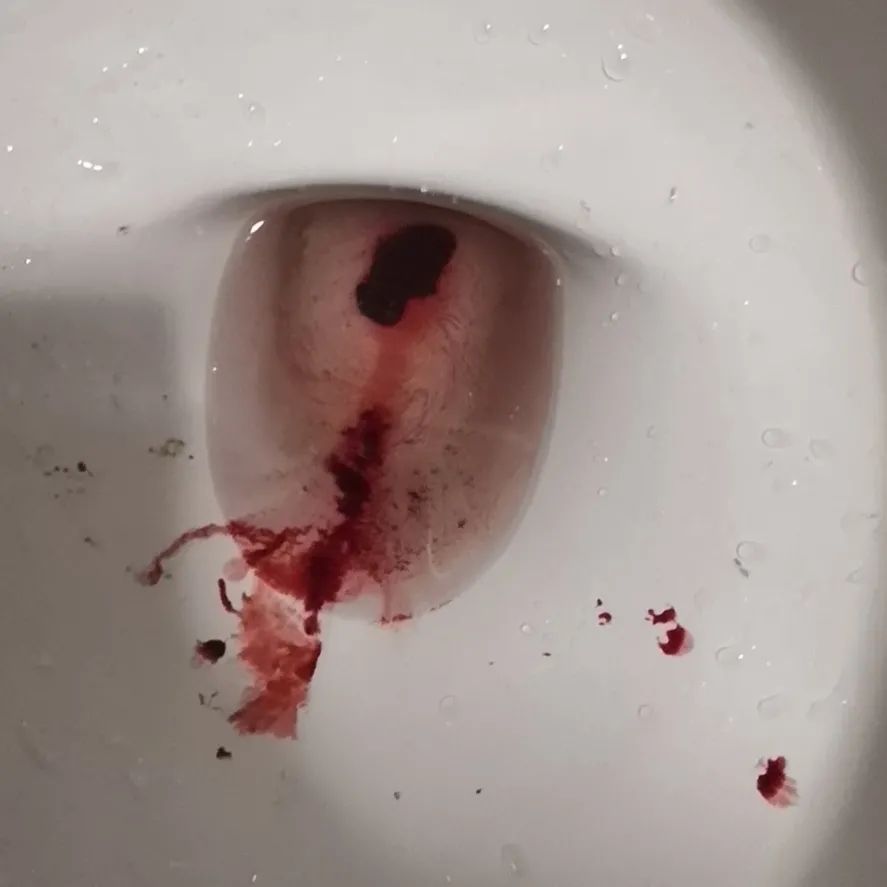 原始点调理胎死腹中案例 原始点调理胎死腹中案例