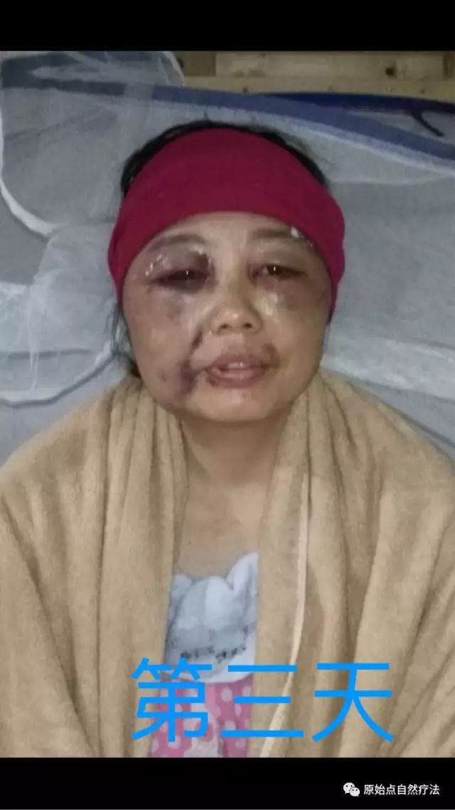 调理车祸案例 调理车祸案例