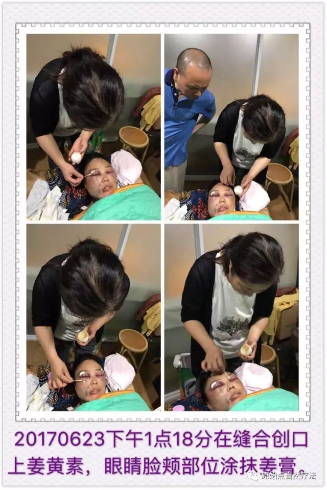 调理车祸案例 调理车祸案例