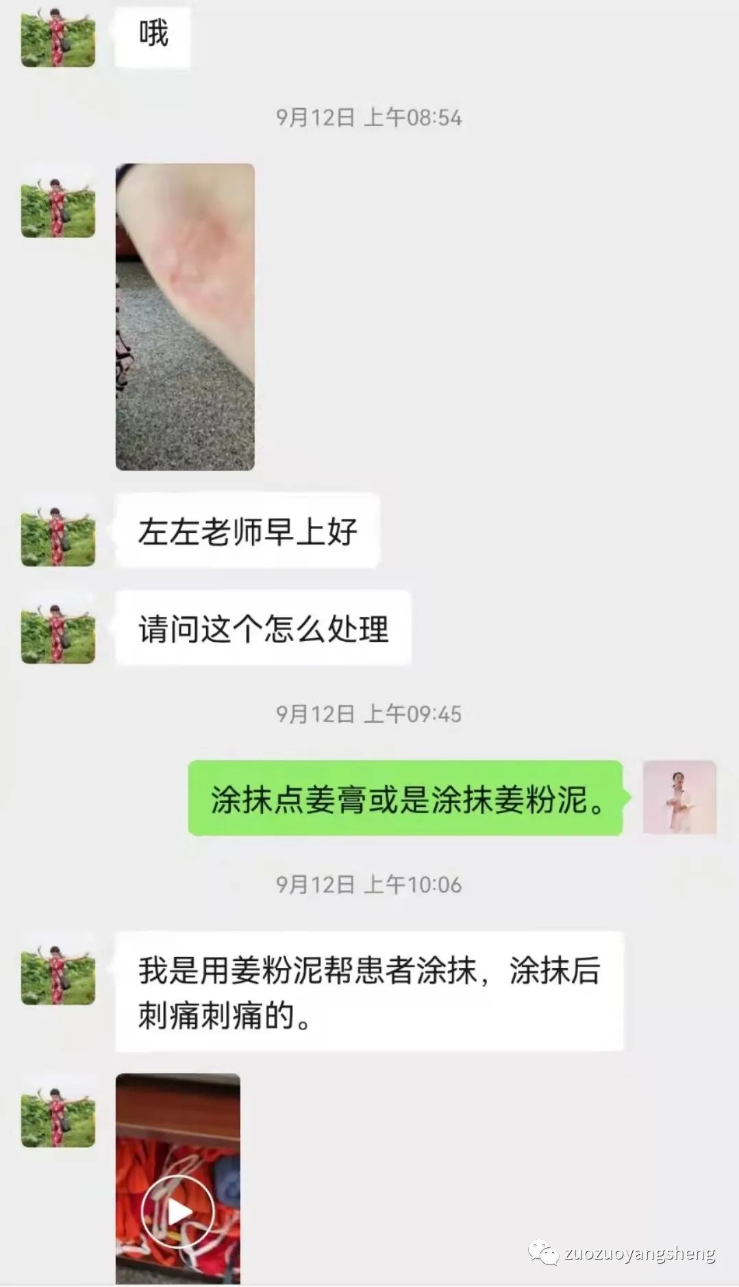 案例分享：原始点调理小孩癫痫、脑发育不全，轻微自闭的案例