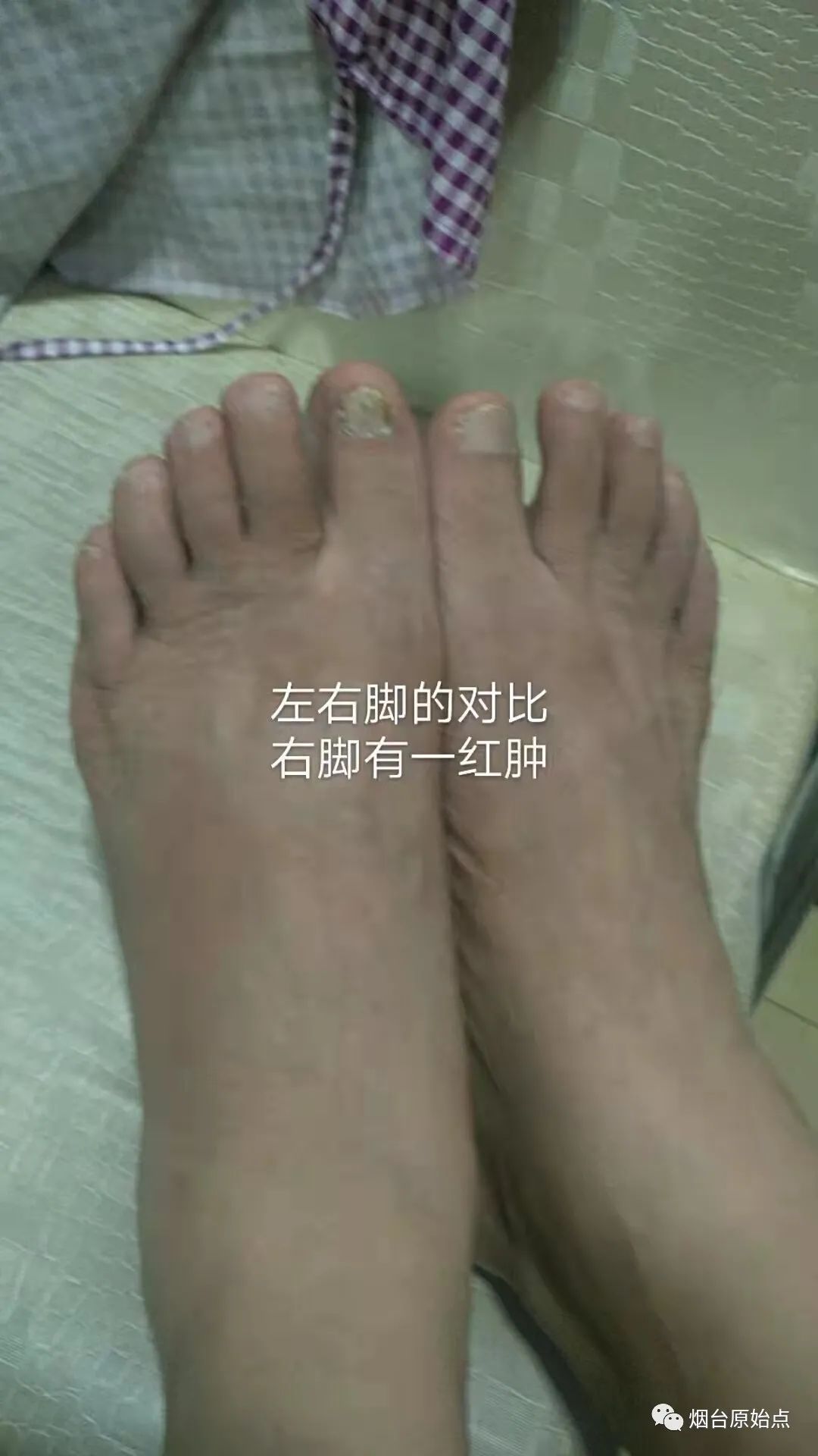 受风寒低烧全身微痛、咽喉吞咽疼、胸闷案例、左脚扭伤案例、结石疼痛案例、胆囊疼痛案例 受风寒低烧全身微痛、咽喉吞咽疼、胸闷案例、左脚扭伤案例、结石疼痛案例、胆囊疼痛案例