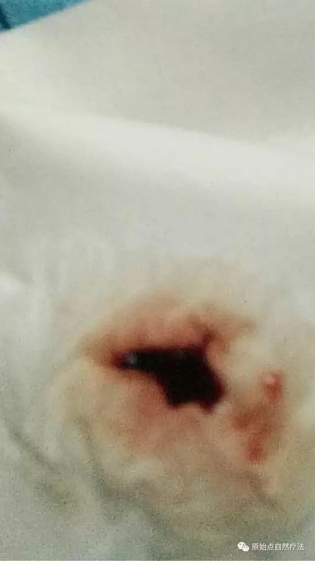 调理车祸案例 调理车祸案例