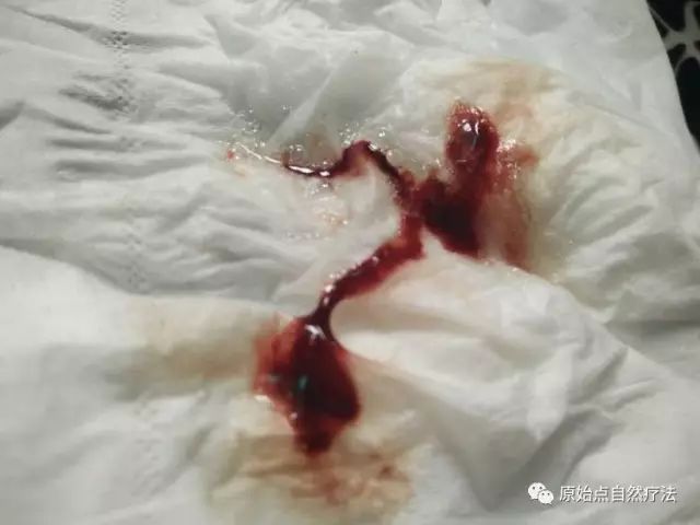 调理车祸案例 调理车祸案例